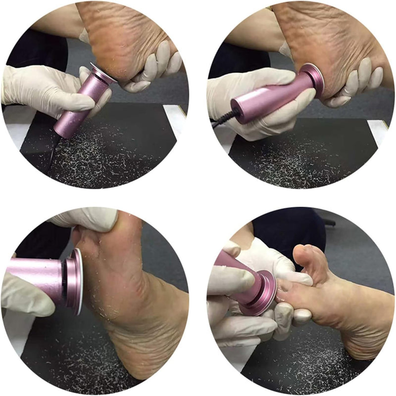 Electric Foot File Callus Remover for Feet