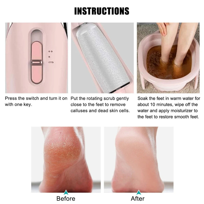 Rechargeable Electric Foot Callus Remover